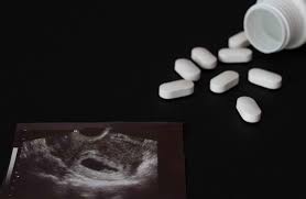 Dampak Kesehatan dan Psikologis pada Bayi dari Kehamilan Pranikah