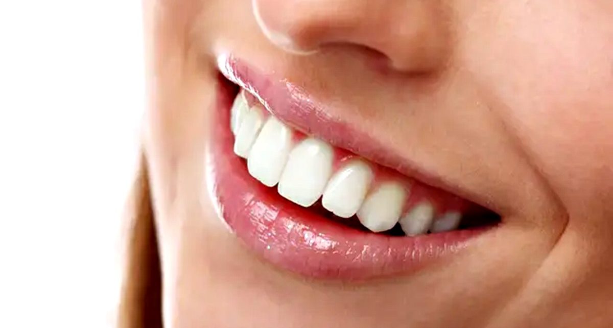9 Cara Terbaik Memutihkan Gigi secara Alami, Bisa Dilakukan di Rumah